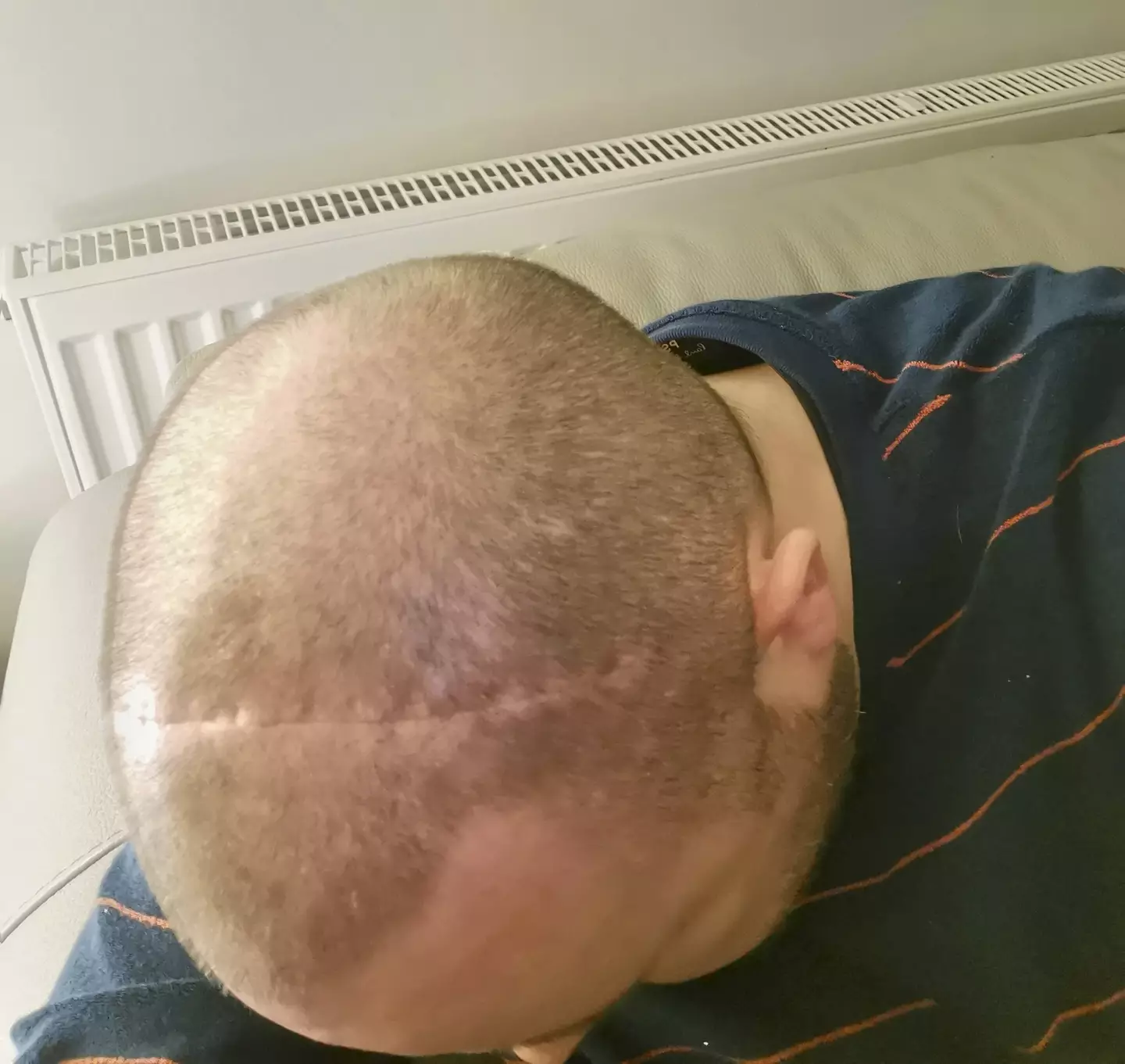 Matt has undergone several treatments since being diagnosed (SWNS)