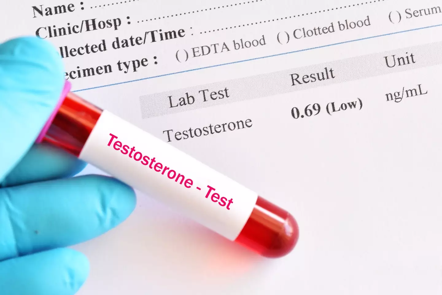 What is low testosterone, and what are the signs? (Getty Stock Images)