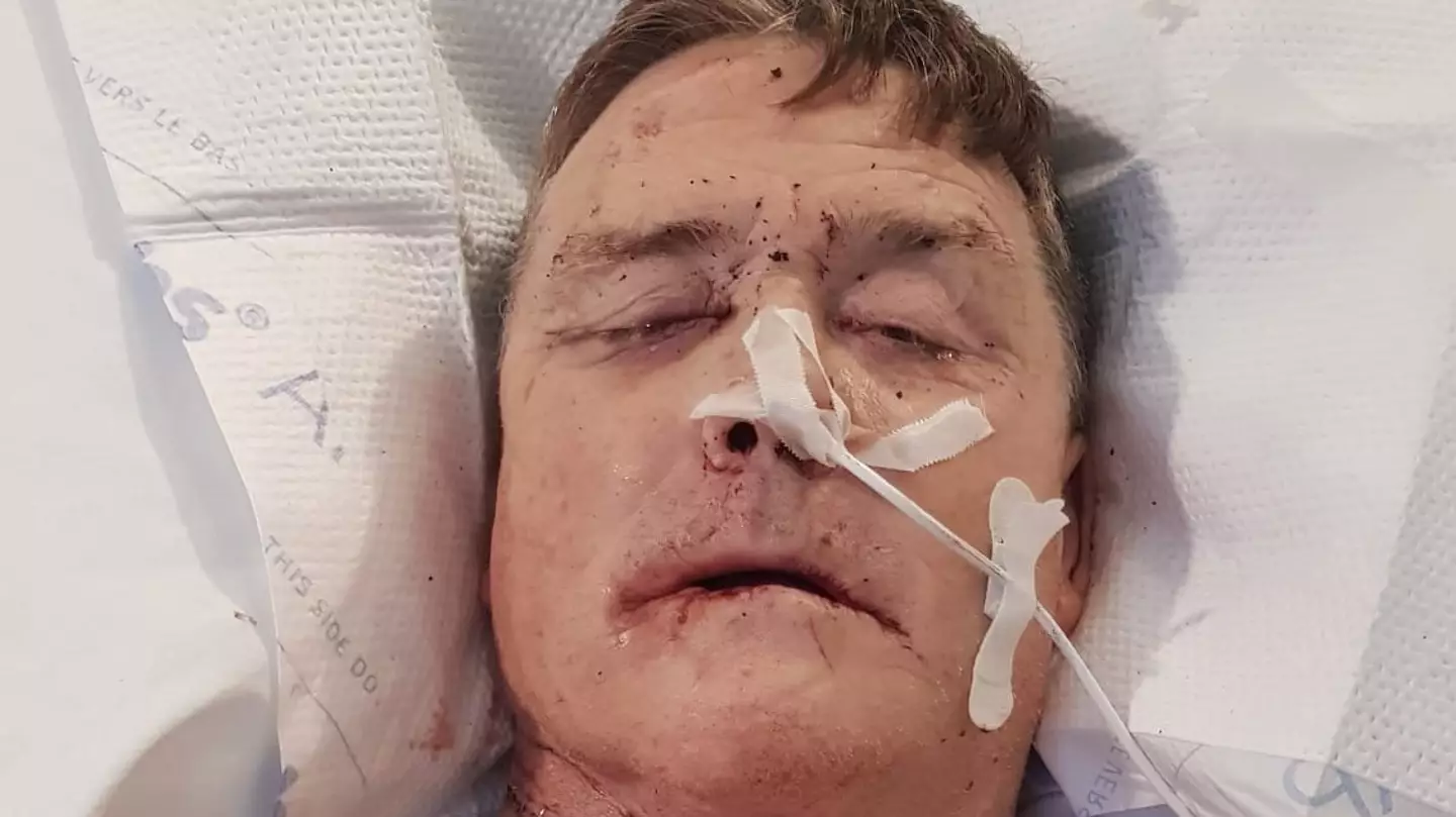 Symptoms of mouth cancer after man spotted unusual warning sign in his teeth that led to shock diagnosis