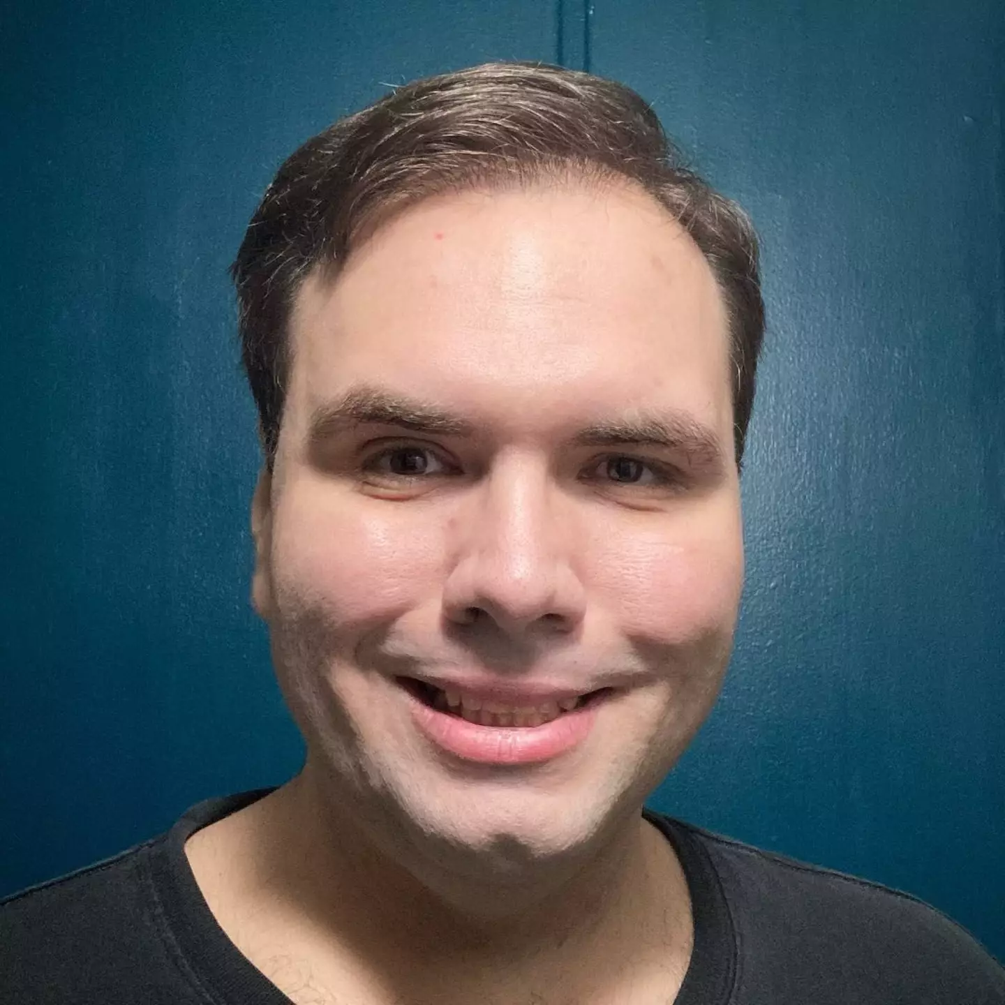 Lucas Higdon looks hugely slimmer in his latest Facebook picture after 175 pound weight loss.