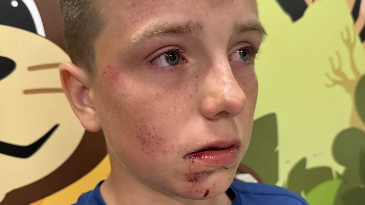 Teen suffers brain injury and nearly bites through own tongue after viral playground 'challenge'