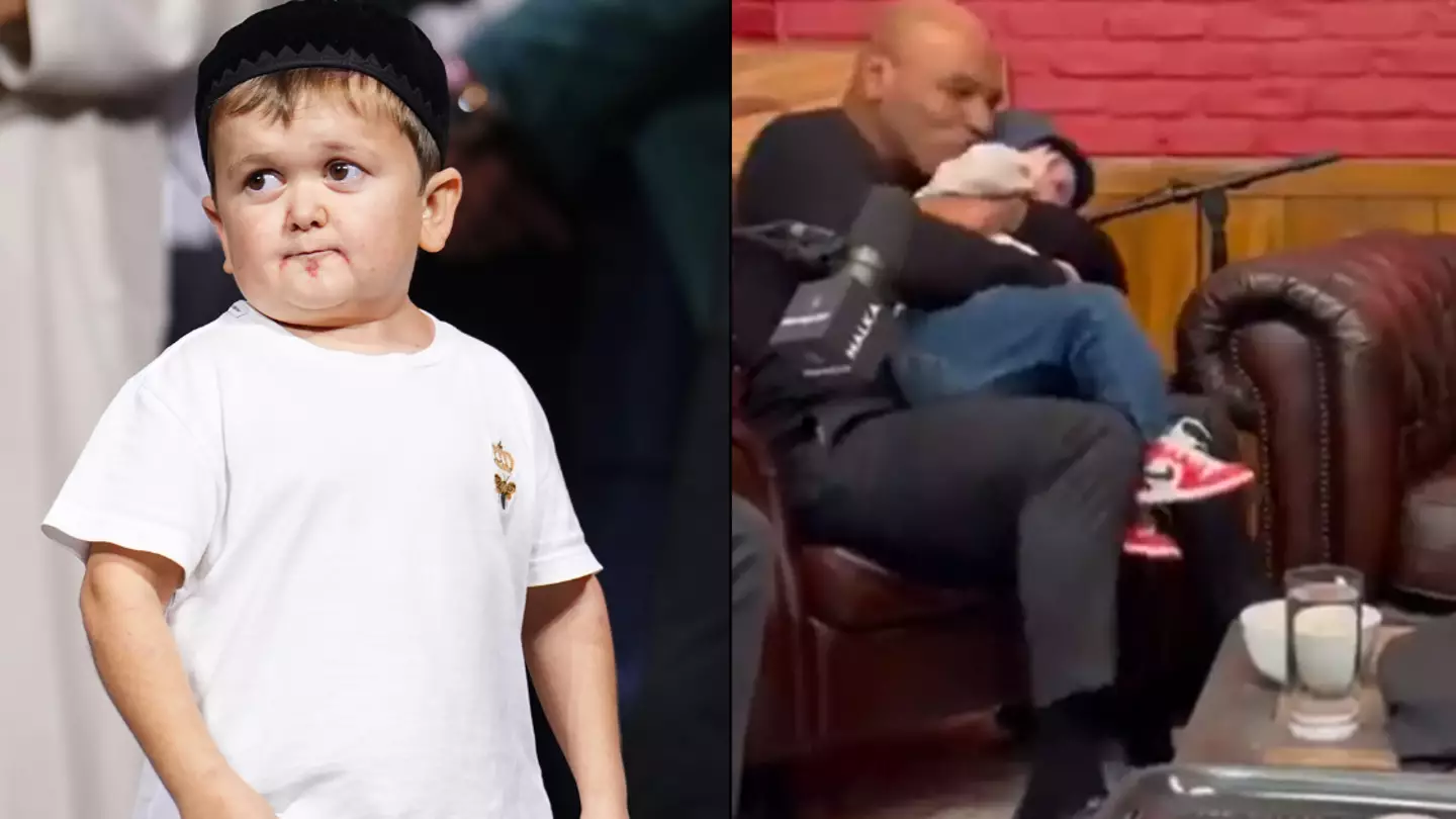 Hasbulla's rare condition explained after Mike Tyson admitted he thought he was a baby