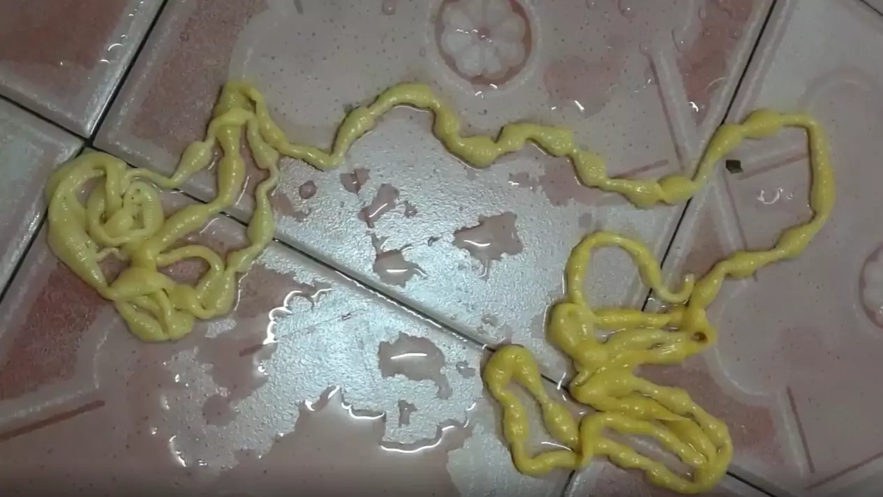 Man Stunned After Pulling 17ft 'Alien' Tapeworm From His Anus