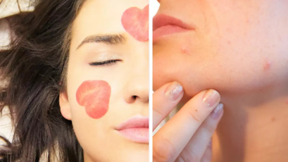 ​Popping A Spot On This Part Of Your Face Could Have Fatal Consequences