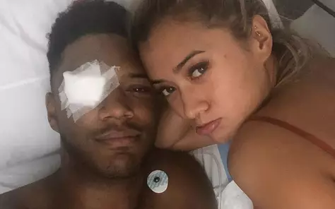 Theo Campbell From 'Love Island' Blind In One Eye After Horror Champagne Cork Accident 