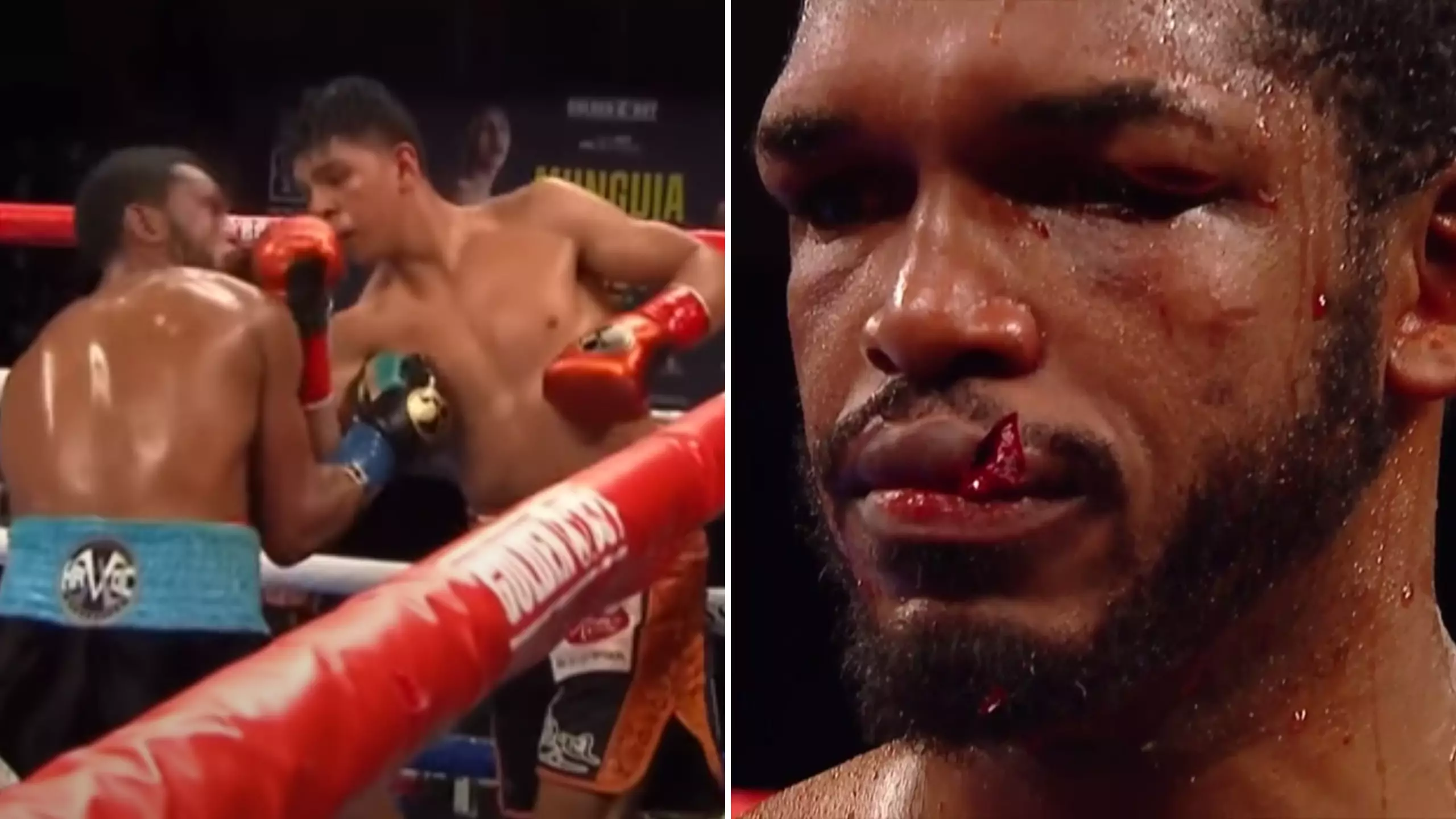Jaime Munguia Busts Tureano Johnson's Lip In One Of Boxing's Most Gruesome Injuries