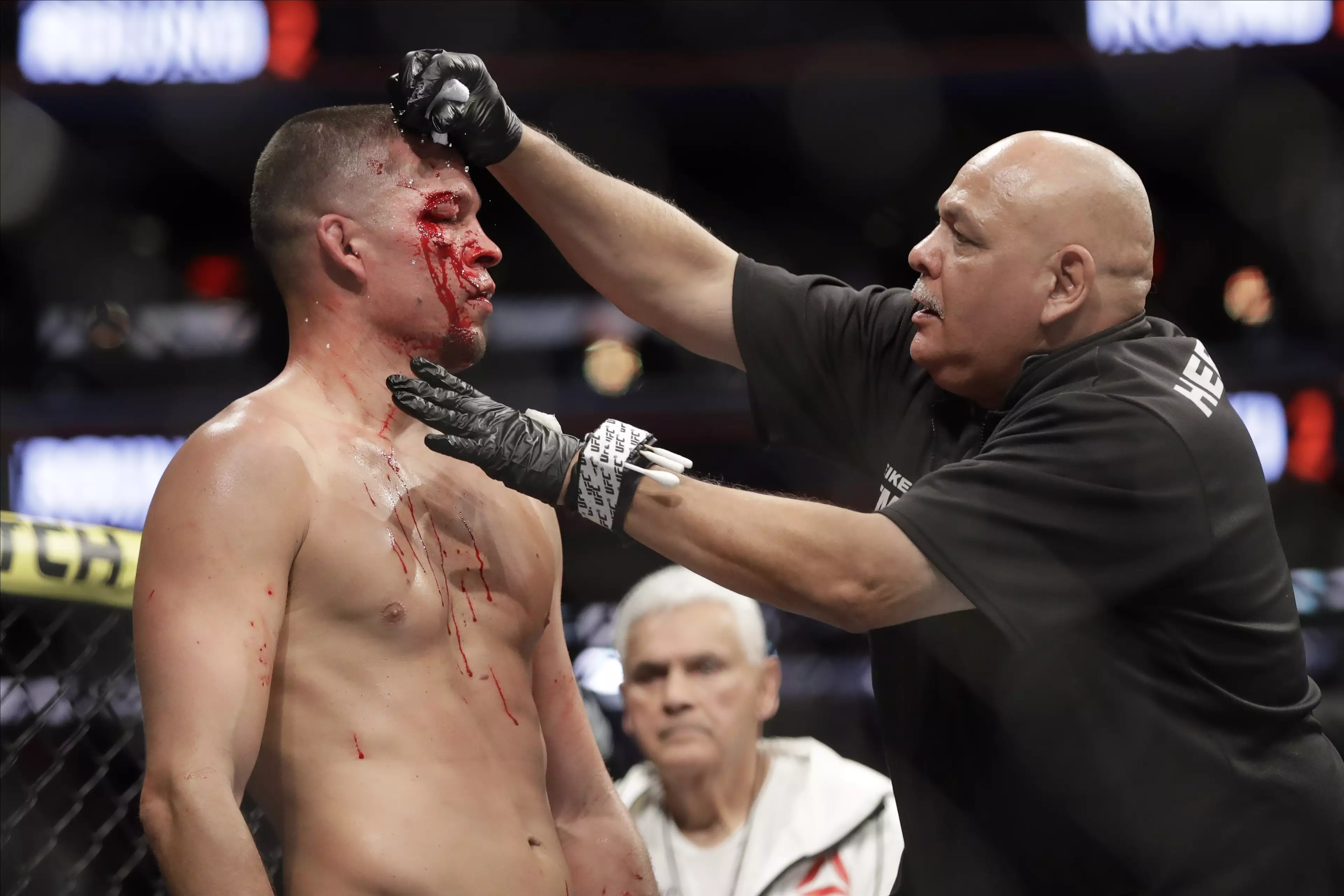 Diaz was cut badly during the fight. Image: PA Images