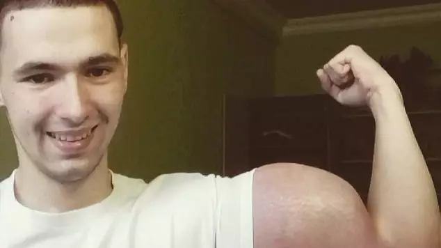 Russian Man Kirill Tereshin Uses Chemicals to Achieve Unnatural Body