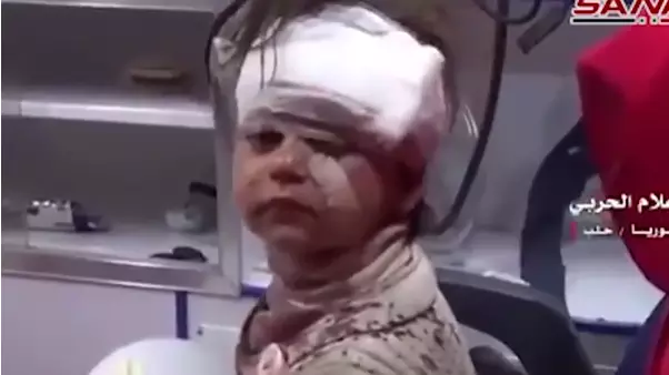 Syrian Girl Injured In Deadly Bus Explosion Adorably Smiles Into Camera 