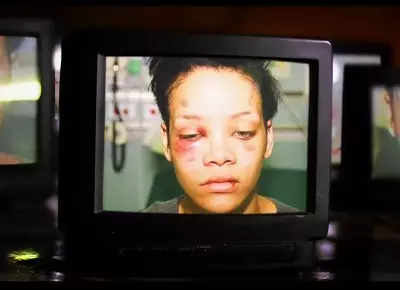 Rihanna after the assault