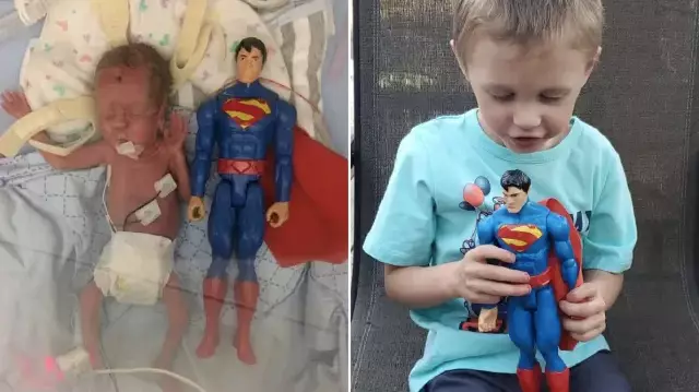 Prematurely Born Baby The Size Of Toy Superman Recovered And Growing Up
