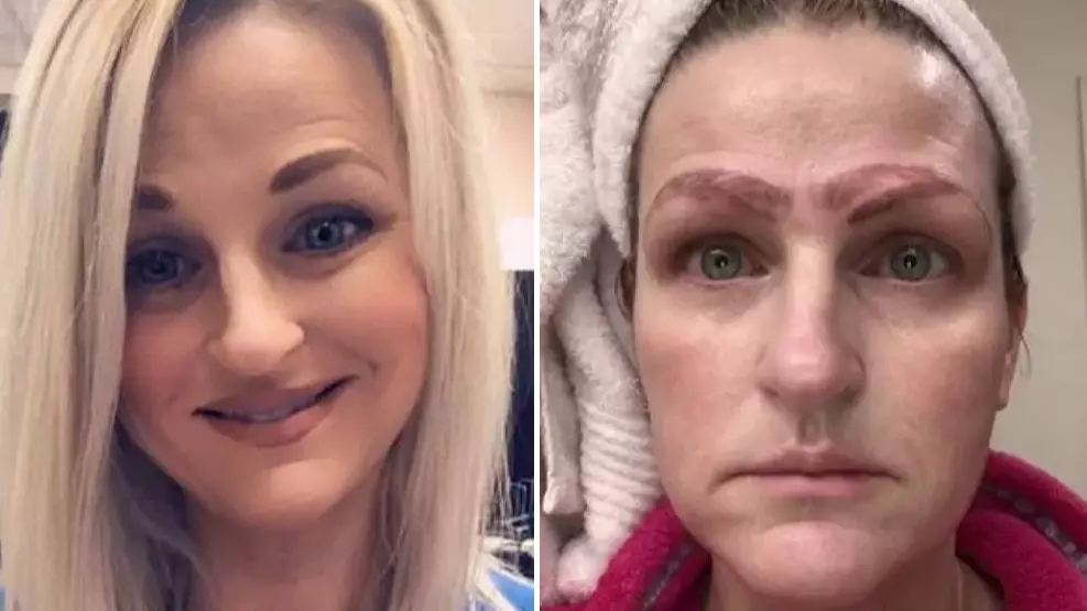 Devastated Mum Claims Botched £190 Microblading Gave Her 'Four Eyebrows'