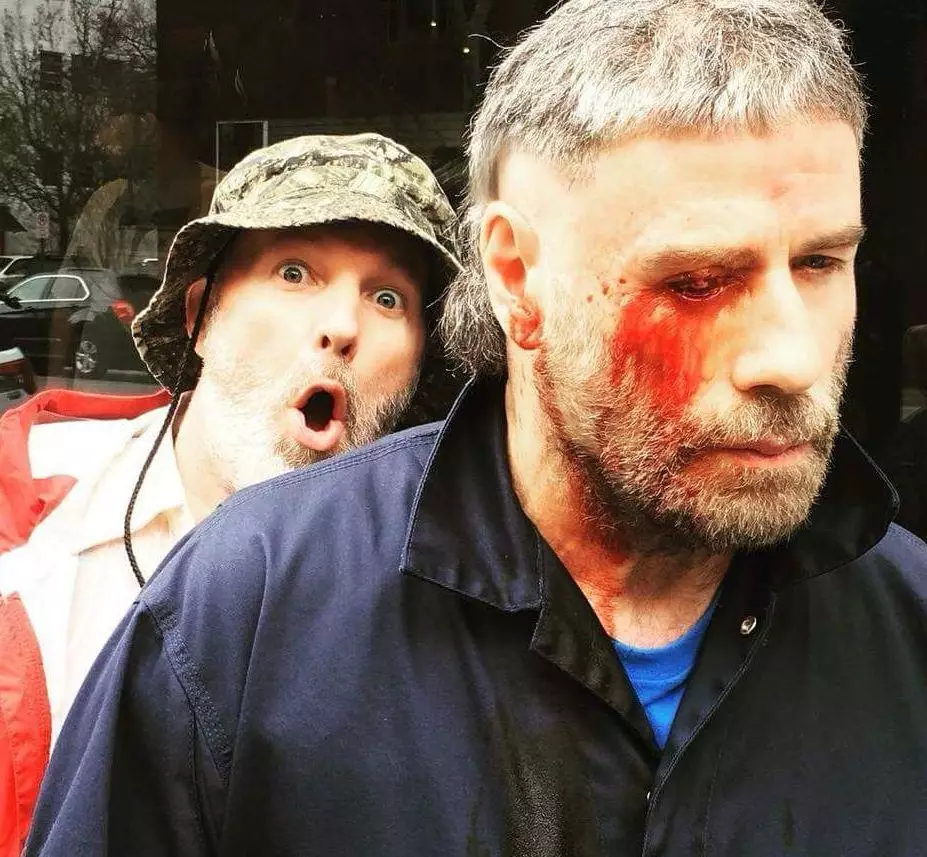 Travolta pictured with a wound to his eye.