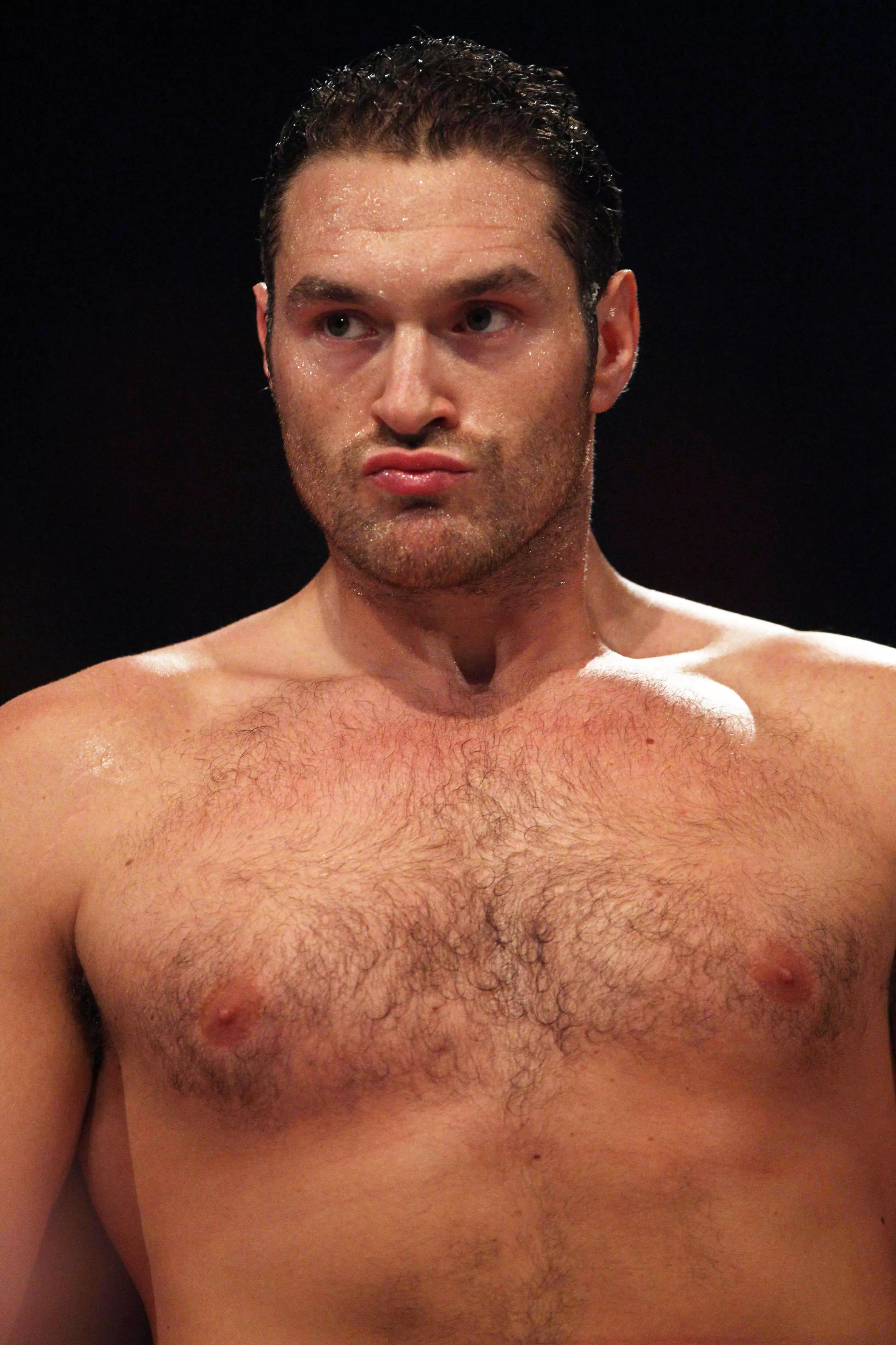 Tyson Fury said he has turned down the offer of a free hair transplant.