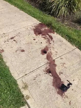 The pavement was left soaked in blood.