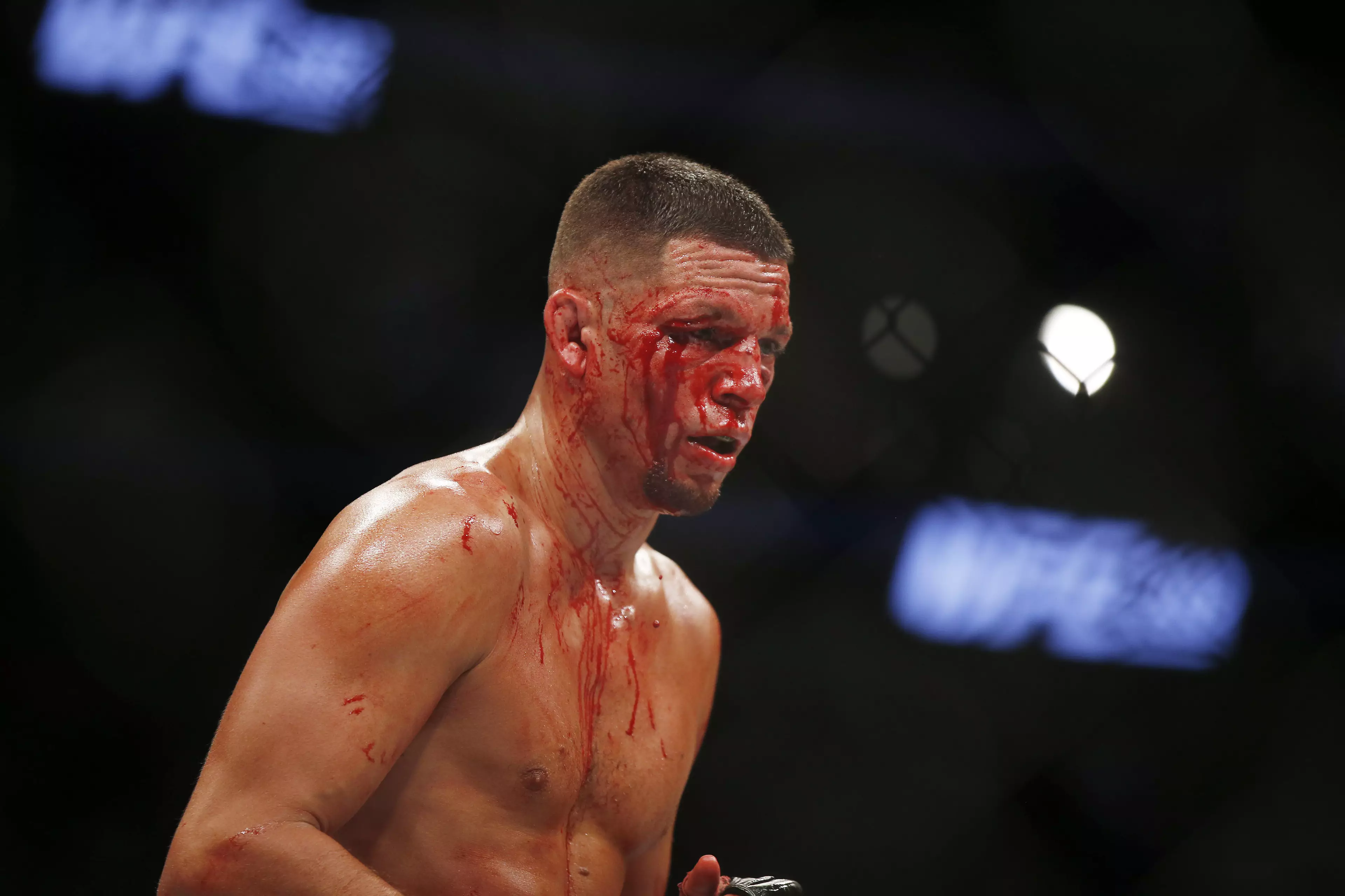 Nate Diaz Changes Tune On Potential Conor McGregor Trilogy Fight
