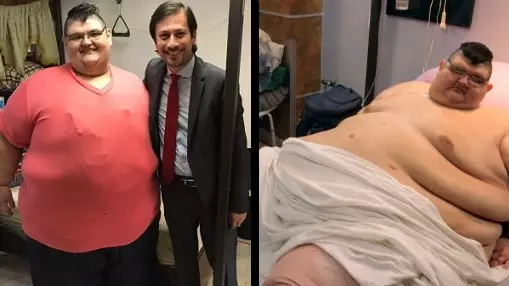 'World's Most Obese Man' Sheds Half His Body Weight After Gastric Surgery