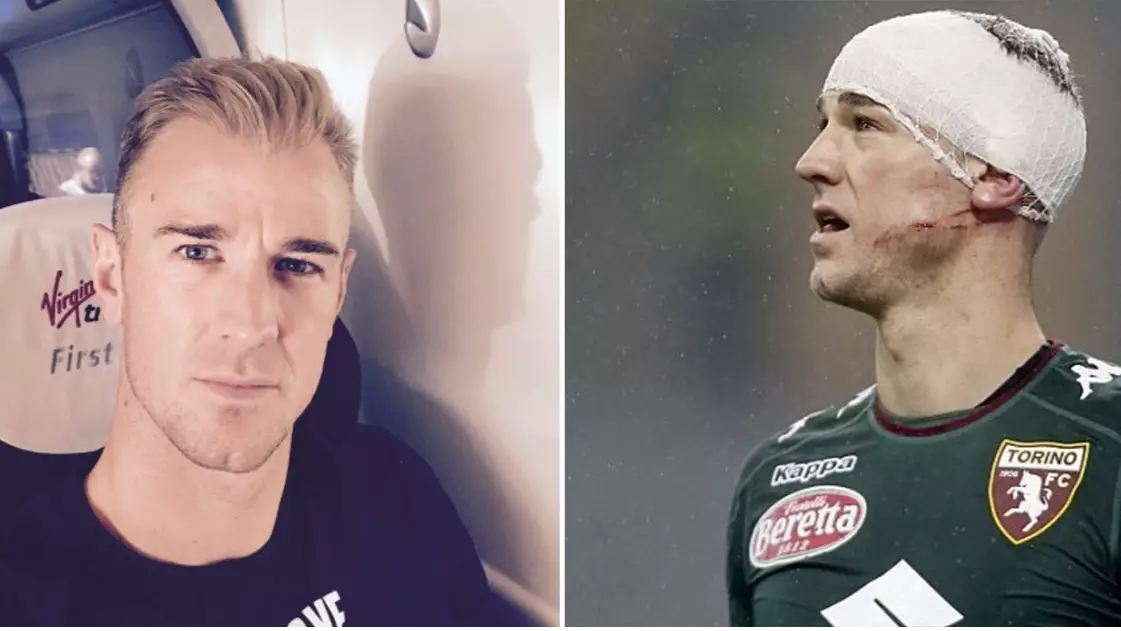 Joe Hart's Selfie On A Train Goes Viral Ahead Of Proposed Medical On Monday 