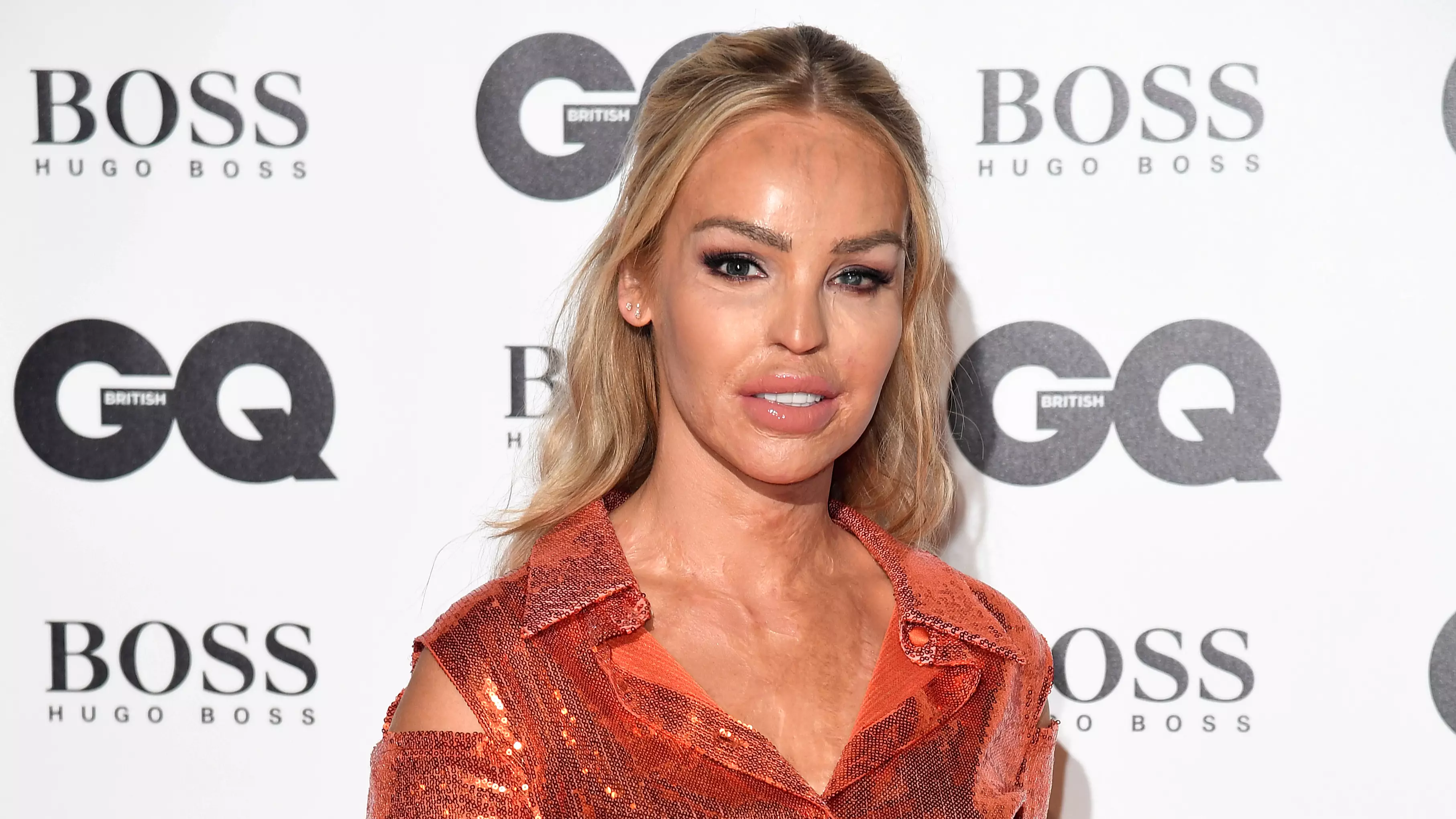 Katie Piper's Acid Attacker Stefan Sylvestre Released From Prison