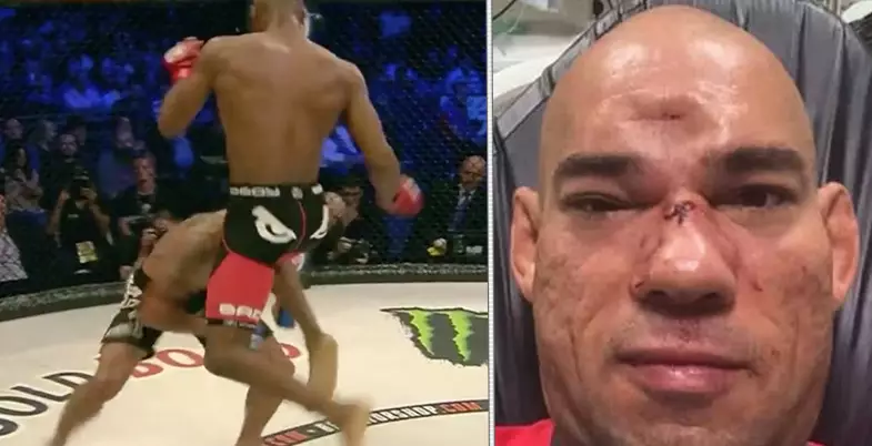 You Won't Forget The Sound Of Cyborg Santos' Skull Cracking In A Hurry