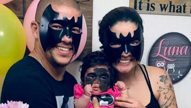 ​Parents Wear 'Batman Mask' In Solidarity With Their Little Girl Who Has A Rare Skin Condition