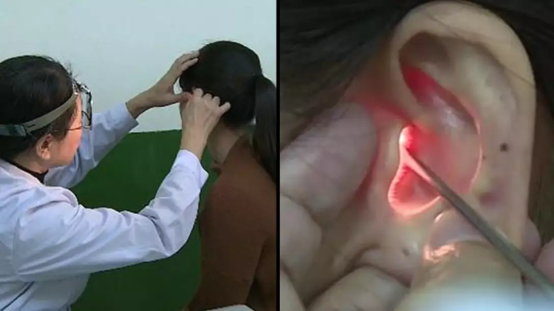 Woman Can't Hear Men's Voices Because Of Rare Condition 