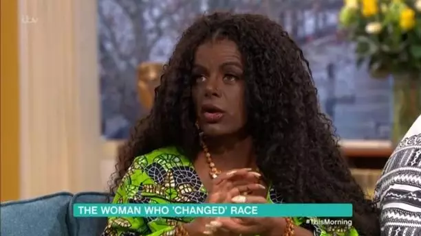 Woman On This Morning Says That She 'Changed Race' With Injections 