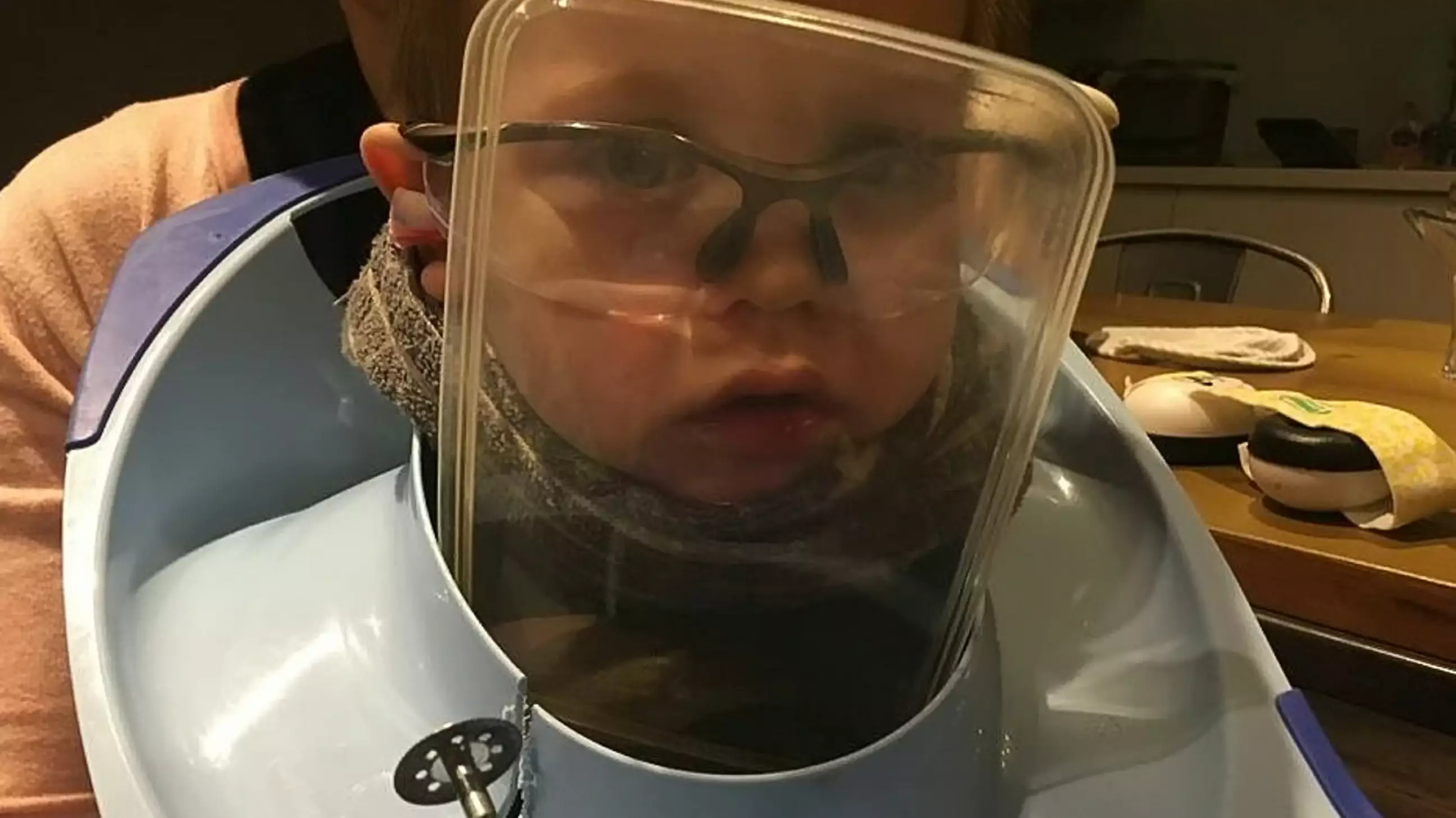 Little Boy Gets Toilet Seat Stuck On His Head, Has To Be Rescued With Disc Cutter 