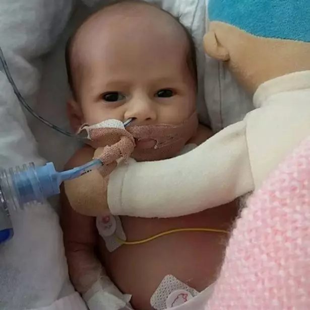 Baby Consy was born with a rare heart condition (