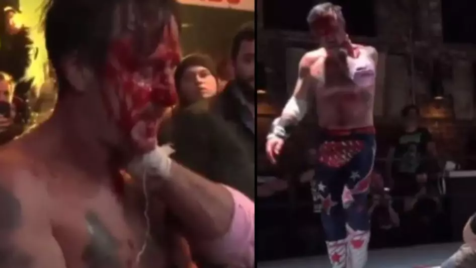 'Scream' Actor David Arquette Suffers Horrific Injury After Wrestling 'Death Match' Turns Ugly
