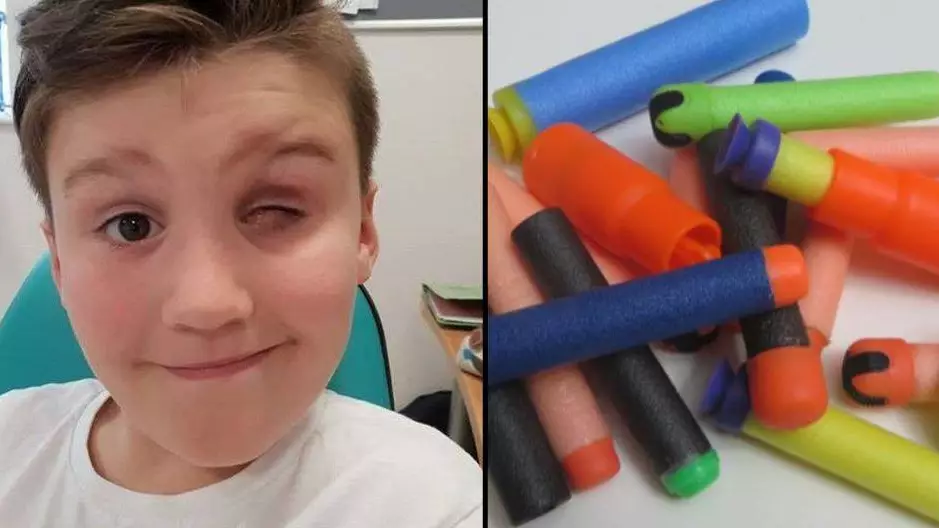 Boy, 9, Loses Eye After Being Shot By A Nerf Gun