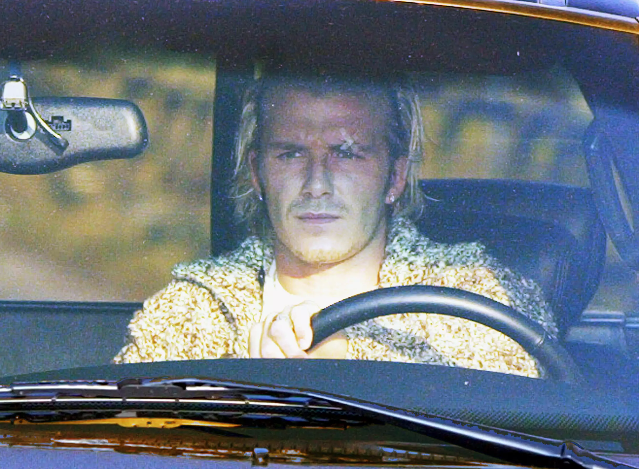 Beckham was papped with the stitches above his eye the next day. Image: PA Images