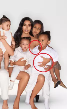 Kim's arm also looked distorted. (