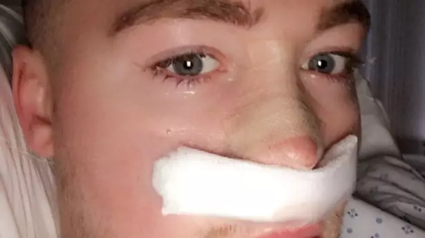 Man Who Spent More Than £80k To Look Like Katie Price Says Nose May Collapse