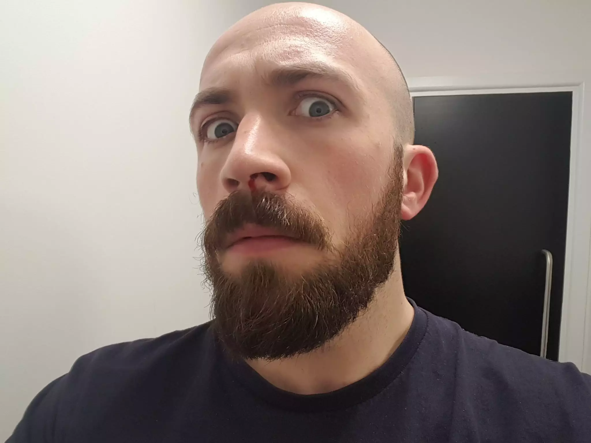 I had two nosebleeds the next day, which I thought was a little unusual/bad.