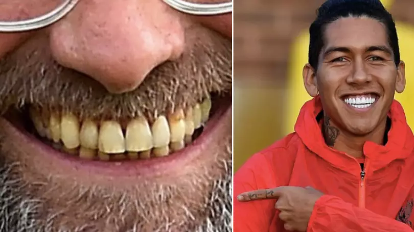 Jurgen Klopp Has New Teeth And They're Brighter Than A Thousand Suns