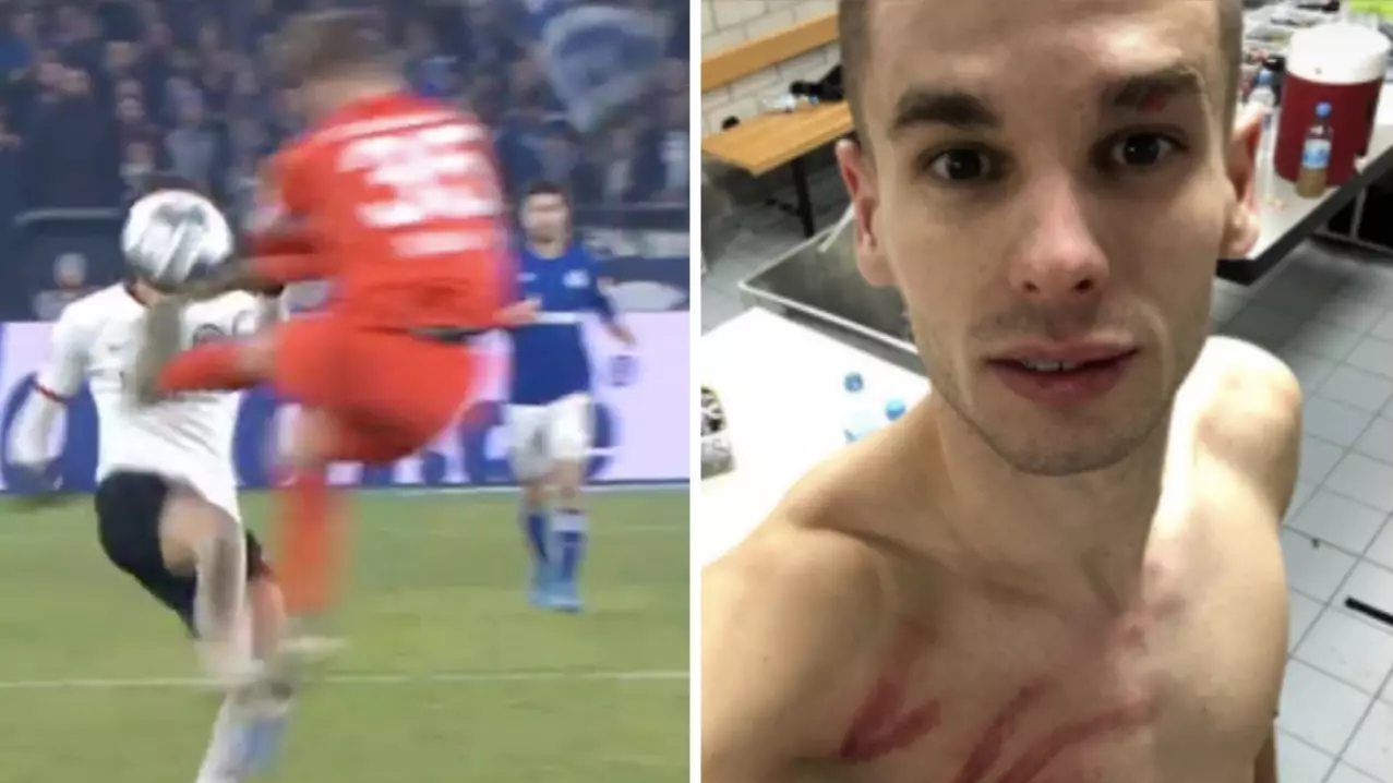 Schalke Goalkeeper Alexander Nubel Given Straight Red For Disgusting 'Karate Kick' Challenge 