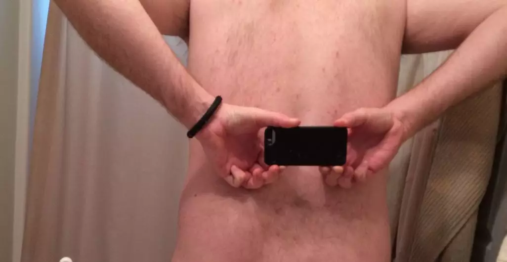 Man With No Arse Crack Answers All The Questions You Wanted To Know