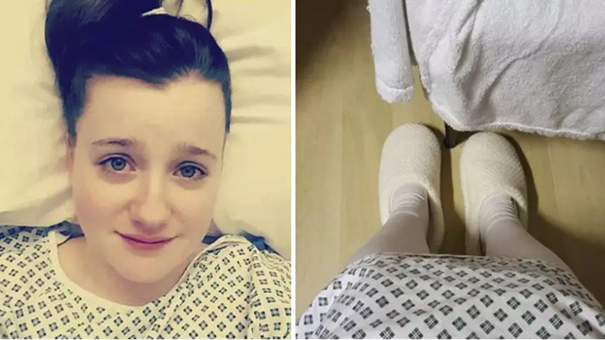 Woman Shares Cervical Cancer Symptoms In Viral Post