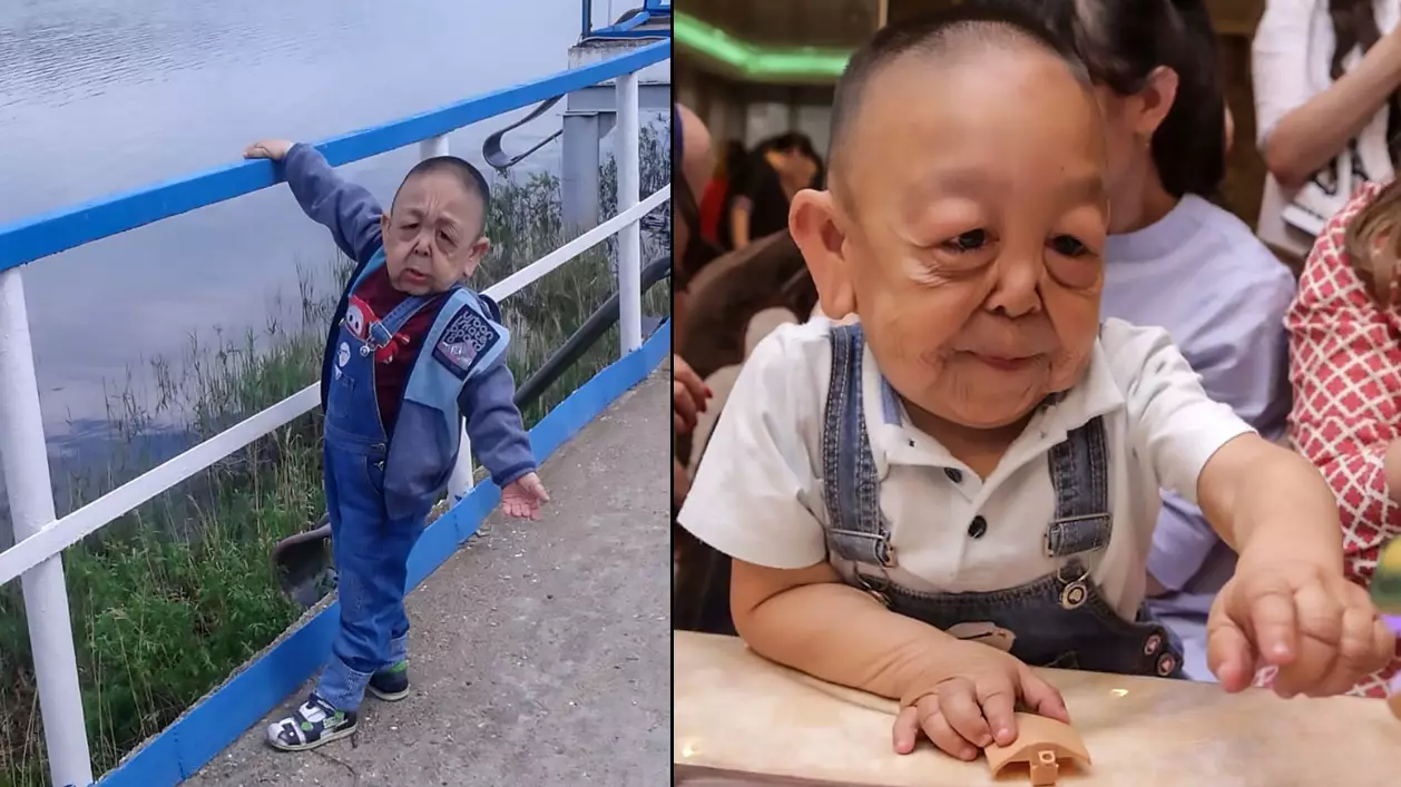 Real Life 'Benjamin Button' Boy Looks A Like Pensioner Aged Six