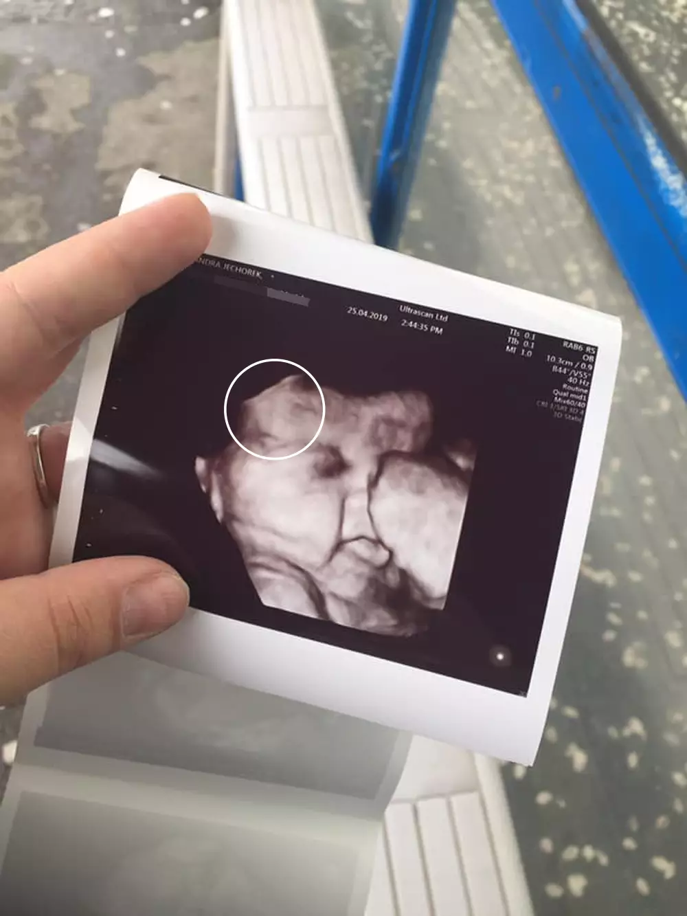 The scan picture that took Alexandra by surprise.