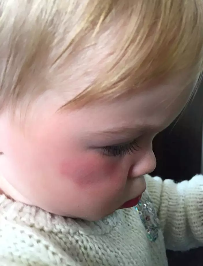Mum Emily Vincent says a flock of seagulls attacked her little girl Jessie.