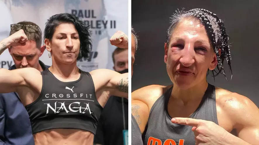 Boxer Who Fought On Jake Paul's Card Looks Completely Unrecognisable After Loss