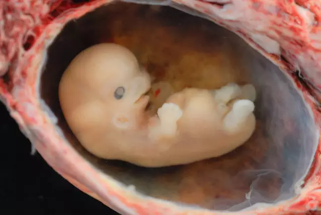 An embryo at 6-7 weeks.