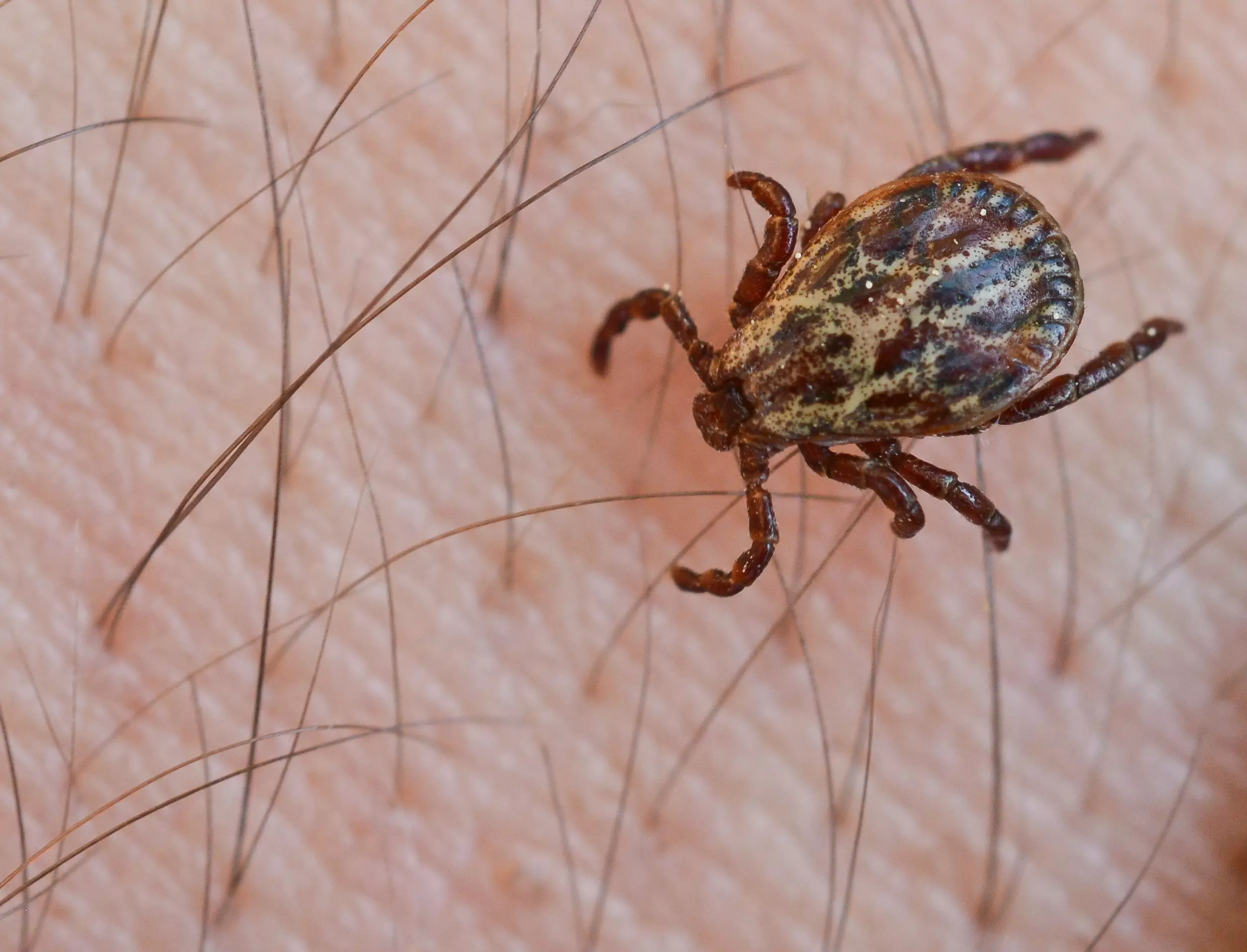 The tick can cause malaria-like symptoms.