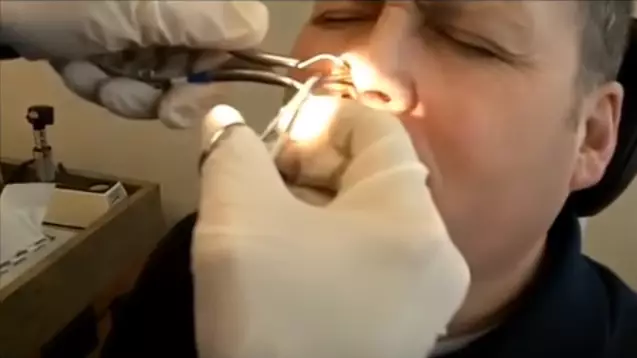 This Video Of A Massive Bogey Getting Removed Is Absolutely Foul