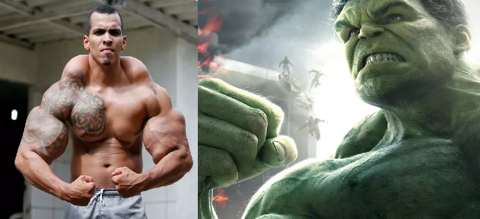 Brazilian Who Wanted To Look Like The Incredible Hulk Had An Epiphany 
