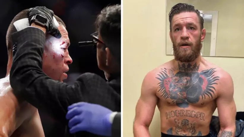 Conor McGregor Reacts To Doctor Stoppage Of Nate Diaz vs Jorge Masvidal Fight 