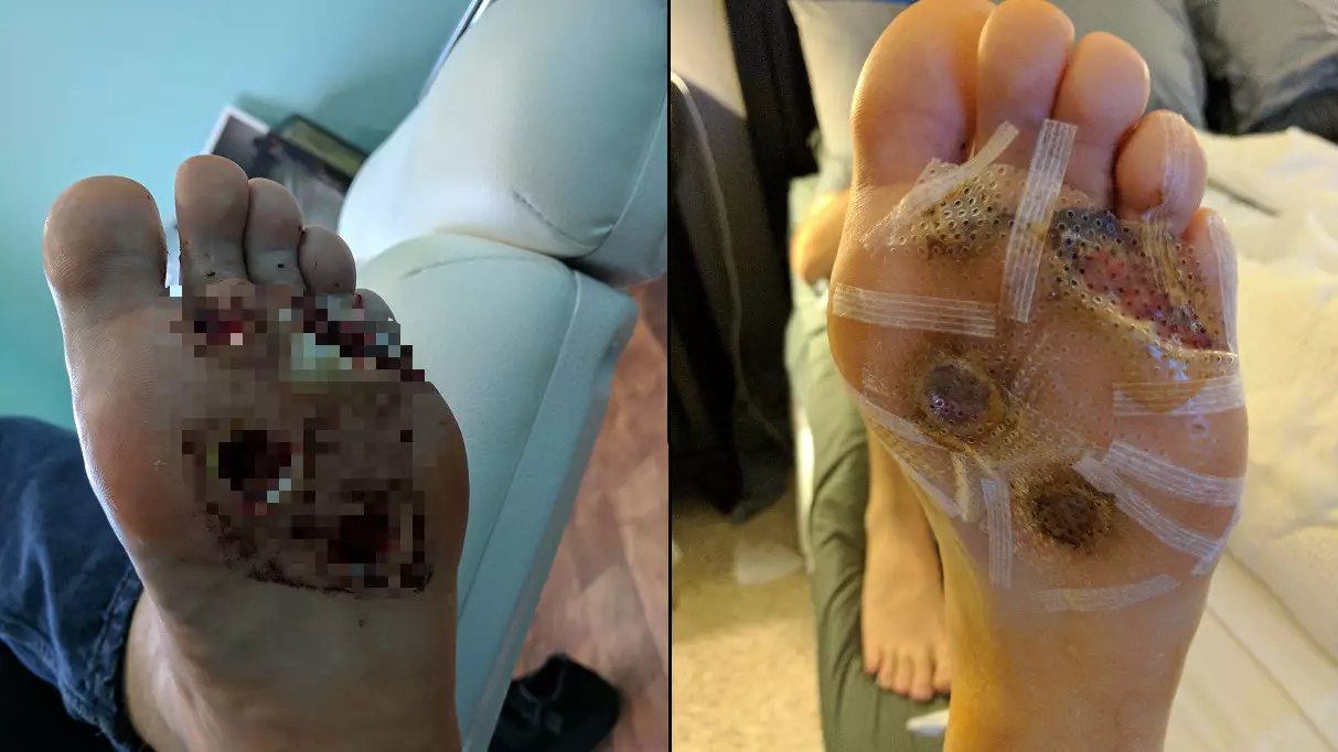 This Is Why You Should NEVER Shower Barefoot In The Gym
