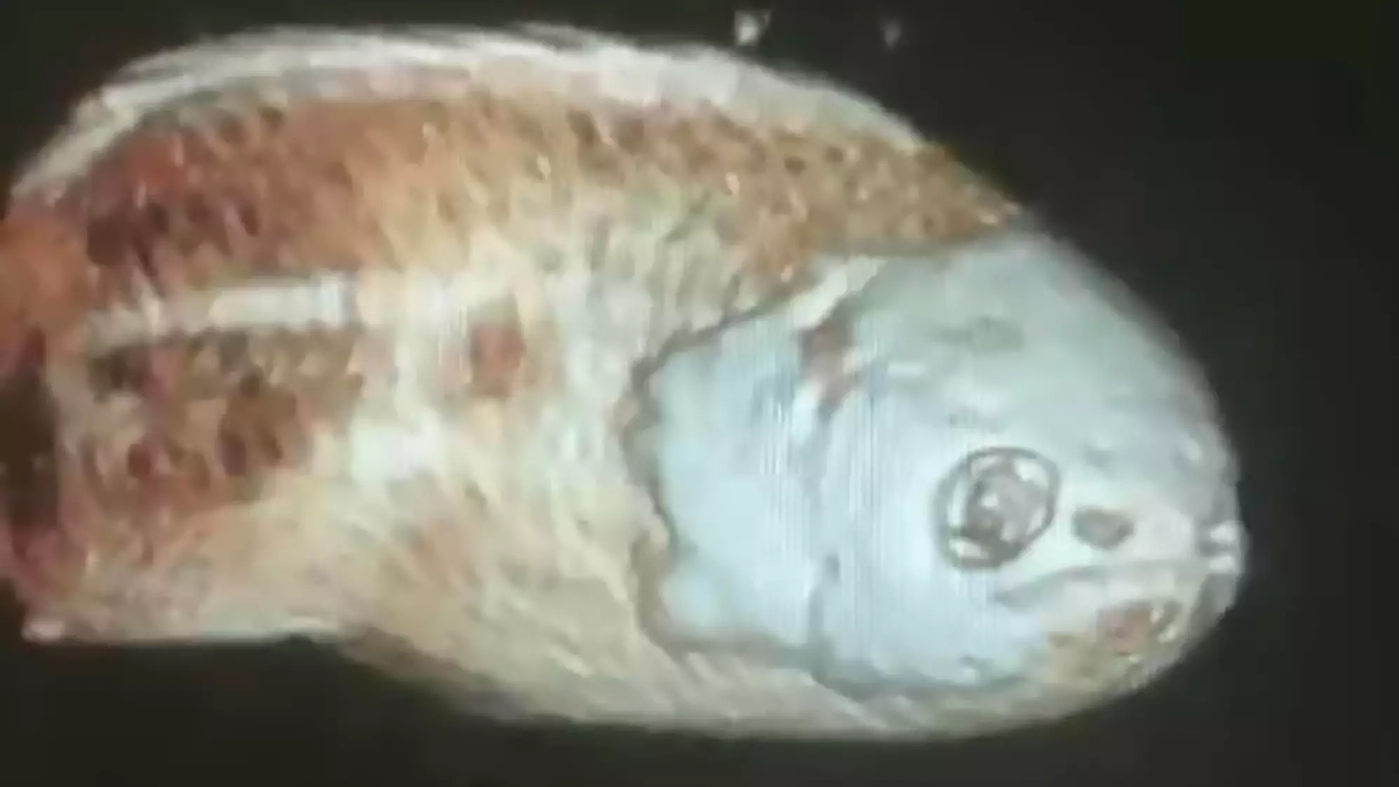 Man Has Whole Fish Stuck In Rectum After 'Sitting On It By Accident'